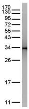 GFP antibody, GTX113617, GeneTex, Immunoprecipitation image 