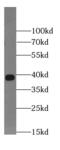 Galectin 4 antibody, FNab03311, FineTest, Western Blot image 