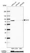 Kinesin Light Chain 2 antibody, NBP1-83722, Novus Biologicals, Western Blot image 