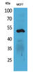 Keratin 14 antibody, STJ96538, St John