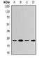 Ubiquitin C-Terminal Hydrolase L3 antibody, orb341443, Biorbyt, Western Blot image 
