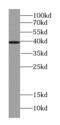 ST6 N-Acetylgalactosaminide Alpha-2,6-Sialyltransferase 6 antibody, FNab08272, FineTest, Western Blot image 