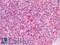 CD33 Molecule antibody, LS-A13027, Lifespan Biosciences, Immunohistochemistry paraffin image 