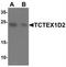 Tctex1 domain-containing protein 2 antibody, NBP2-81831, Novus Biologicals, Western Blot image 