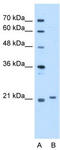 Titin-Cap antibody, TA346578, Origene, Western Blot image 