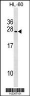 Ubiquitin Conjugating Enzyme E2 S antibody, 60-855, ProSci, Western Blot image 