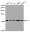 Ubiquitin Conjugating Enzyme E2 C antibody, LS-C334094, Lifespan Biosciences, Western Blot image 