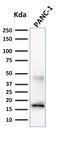 Chymotrypsin Like Elastase 3B antibody, GTX34687, GeneTex, Western Blot image 