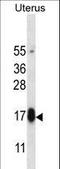 Glycoprotein Hormone Subunit Beta 5 antibody, LS-C166608, Lifespan Biosciences, Western Blot image 