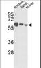 Insulin Like Growth Factor Binding Protein Acid Labile Subunit antibody, LS-C100687, Lifespan Biosciences, Western Blot image 