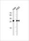 Eukaryotic Translation Elongation Factor 1 Beta 2 antibody, 61-031, ProSci, Western Blot image 