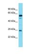 CCR4-NOT Transcription Complex Subunit 10 antibody, orb326956, Biorbyt, Western Blot image 