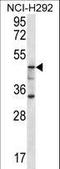 Cytosolic beta-glucosidase antibody, LS-C166390, Lifespan Biosciences, Western Blot image 