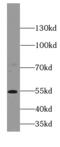p101-PI3K antibody, FNab06416, FineTest, Western Blot image 