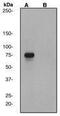 RAD17 Checkpoint Clamp Loader Component antibody, GTX61991, GeneTex, Western Blot image 