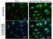 Snail Family Transcriptional Repressor 1 antibody, GTX125918, GeneTex, Immunofluorescence image 