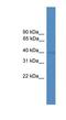 Nuclear Factor, Erythroid 2 antibody, NBP1-69226, Novus Biologicals, Western Blot image 