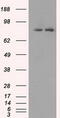 SCY1 Like Pseudokinase 3 antibody, M11167, Boster Biological Technology, Western Blot image 