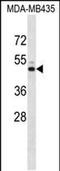 Potassium Voltage-Gated Channel Subfamily J Member 13 antibody, PA5-48366, Invitrogen Antibodies, Western Blot image 