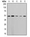 StAR Related Lipid Transfer Domain Containing 3 antibody, orb382061, Biorbyt, Western Blot image 
