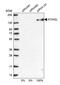 Ataxin 2 Like antibody, PA5-59601, Invitrogen Antibodies, Western Blot image 