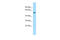 Amylase Alpha 1C (Salivary) antibody, ARP54700_P050, Aviva Systems Biology, Western Blot image 