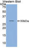 Kallikrein Related Peptidase 5 antibody, LS-C294972, Lifespan Biosciences, Western Blot image 