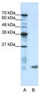 SRA Stem-Loop Interacting RNA Binding Protein antibody, TA343941, Origene, Western Blot image 