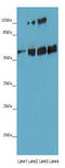 Angiopoietin Like 2 antibody, A51389-100, Epigentek, Western Blot image 