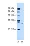 Syndecan Binding Protein antibody, NBP1-59336, Novus Biologicals, Western Blot image 