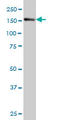 Insulin Receptor Substrate 4 antibody, LS-C198571, Lifespan Biosciences, Western Blot image 