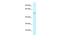 Carboxypeptidase A5 antibody, PA5-70412, Invitrogen Antibodies, Western Blot image 