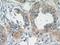 Thymidine Kinase 1 antibody, 15691-1-AP, Proteintech Group, Immunohistochemistry paraffin image 