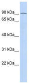 TCDD-inducible poly [ADP-ribose] polymerase antibody, TA334264, Origene, Western Blot image 