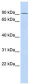 TCDD Inducible Poly(ADP-Ribose) Polymerase antibody, TA334264, Origene, Western Blot image 