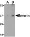 Emerin antibody, MBS150246, MyBioSource, Western Blot image 