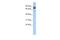 NOP9 Nucleolar Protein antibody, A12108, Boster Biological Technology, Western Blot image 