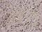 Double PHD Fingers 2 antibody, NBP2-16217, Novus Biologicals, Immunohistochemistry paraffin image 