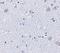 BR Serine/Threonine Kinase 1 antibody, NBP1-77280, Novus Biologicals, Immunohistochemistry frozen image 