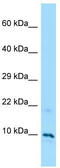 Mono-ADP Ribosylhydrolase 2 antibody, TA334323, Origene, Western Blot image 