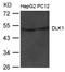 Delta Like Non-Canonical Notch Ligand 1 antibody, A00513-1, Boster Biological Technology, Western Blot image 