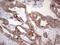 Galectin 3 antibody, LS-C339301, Lifespan Biosciences, Immunohistochemistry paraffin image 