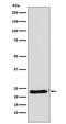 CASP2 And RIPK1 Domain Containing Adaptor With Death Domain antibody, M06509-2, Boster Biological Technology, Western Blot image 