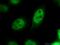 Caudal Type Homeobox 1 antibody, 21655-1-AP, Proteintech Group, Immunofluorescence image 
