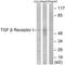 Transforming Growth Factor Beta Receptor 1 antibody, LS-C117992, Lifespan Biosciences, Western Blot image 