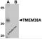 Transmembrane Protein 38A antibody, 5521, ProSci, Western Blot image 
