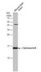 Protein Phosphatase 3 Regulatory Subunit B, Alpha antibody, NBP2-15664, Novus Biologicals, Western Blot image 