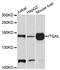 Integrin Subunit Alpha L antibody, MBS126471, MyBioSource, Western Blot image 
