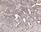 Cbl Proto-Oncogene antibody, A00152-2, Boster Biological Technology, Immunohistochemistry paraffin image 