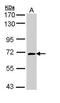 Collapsin Response Mediator Protein 1 antibody, PA5-34768, Invitrogen Antibodies, Western Blot image 